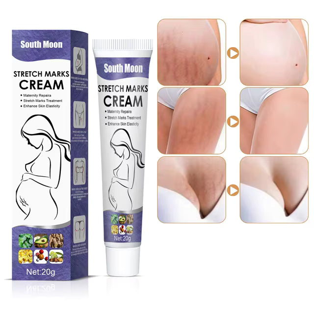 Crème Anti-Vergetures South Moon