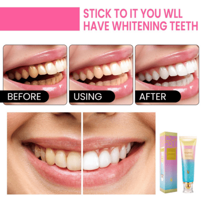 Pâte dentifrice blanchissante  | BodyAccel™